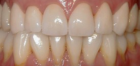 Waterford Dental Health | Night Guards, Preventative Program and Digital Radiography