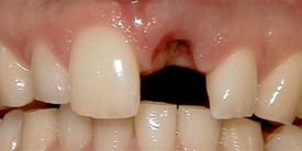 Waterford Dental Health | CBCT, Crowns and Periodontal Treatment