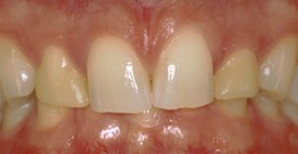 Waterford Dental Health | Cosmetic Dentistry, Dental Sealants and Dental Fillings