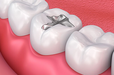 Waterford Dental Health | Invisalign reg , Veneers and Pediatric Dentistry
