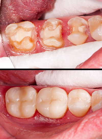 Waterford Dental Health | Night Guards, Veneers and Cosmetic Dentistry