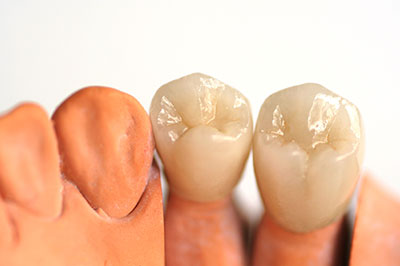 Waterford Dental Health | Oral Exams, Night Guards and Dentures