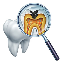 Waterford Dental Health | Preventative Program, Ceramic Crowns and Orthodontics