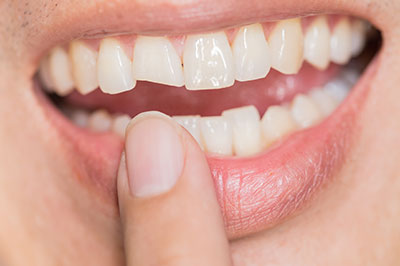 Waterford Dental Health | All-on-6 reg , Invisalign reg  and Extractions