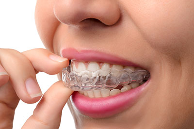 Waterford Dental Health | Preventative Program, Dentures and Invisalign reg 