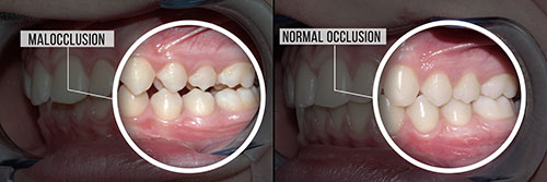 Waterford Dental Health | Periodontal Treatment, Invisalign reg  and Dental Cleanings