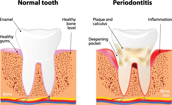 Waterford Dental Health | Veneers, Ceramic Crowns and CBCT