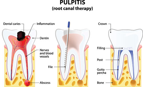 Waterford Dental Health | Oral Exams, Crowns and Invisalign reg 