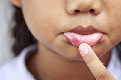 Waterford Dental Health | Dental Sealants, Dental Fillings and Digital Impressions