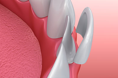 Waterford Dental Health | Sedation Dentistry, Dental Fillings and Crowns