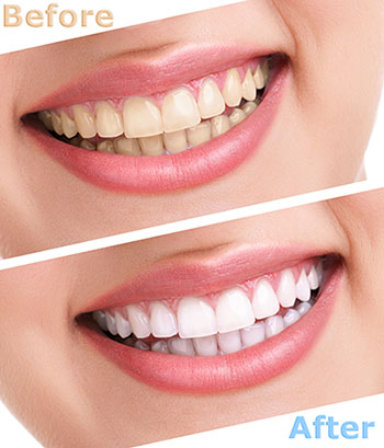 Waterford Dental Health | Oral Cancer Screening, Intraoral Camera and Pediatric Dentistry