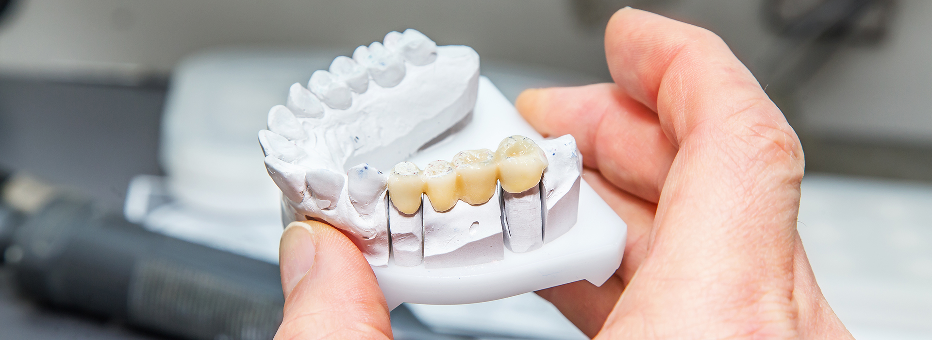 Waterford Dental Health | Full Mouth Reconstruction, Root Canals and Crowns