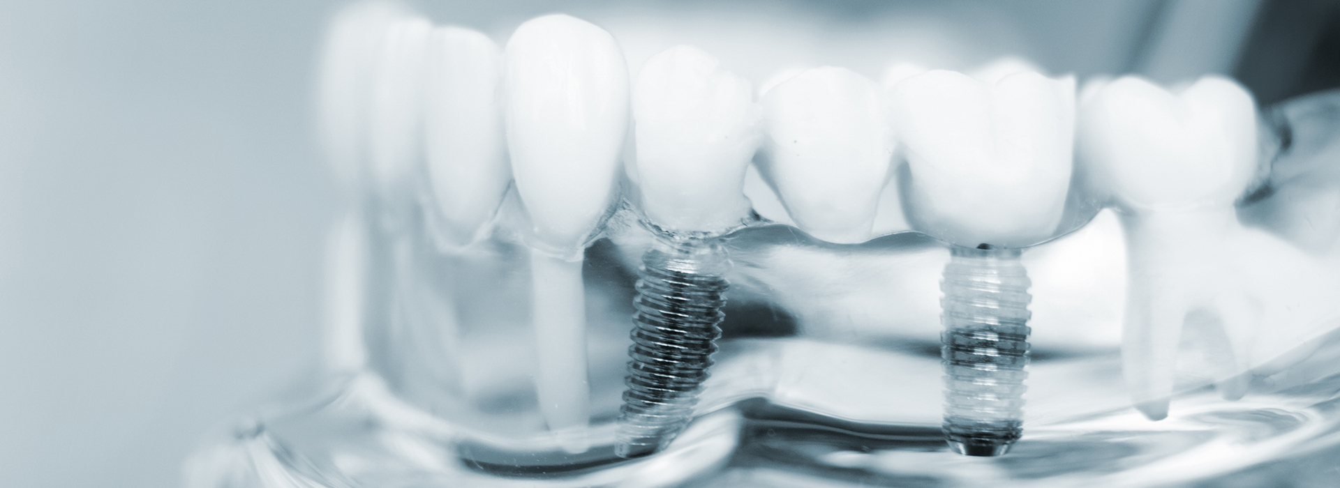 Waterford Dental Health | Intraoral Camera, Extractions and Digital Impressions