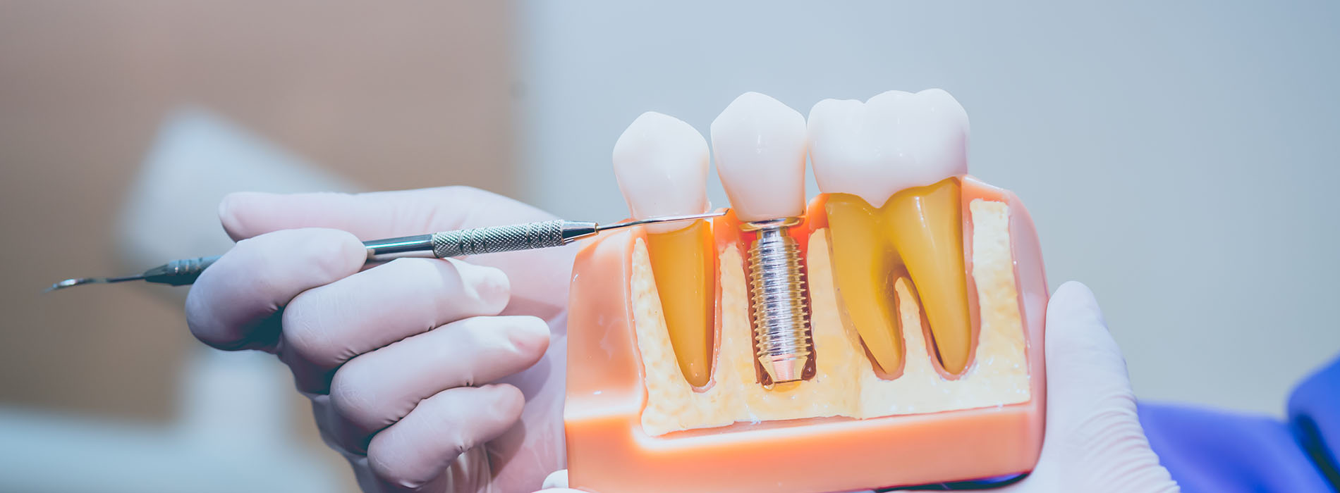 Waterford Dental Health | All-on-4 reg , Emergency Treatment and Dentures